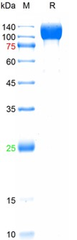 Recombinant SARS-Cov-1 Spike S1 protein, His (HEK293)