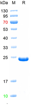 Recombinant human RBP4 protein, C-His (HEK293)