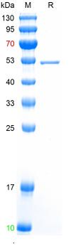 Recombinant SARS-Cov-2 (Omicron, B.1.1.529) N protein (P13L, E31del, R32del, S33del, R203K, G204R), N-His