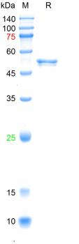 Recombinant SARS-Cov-2 N protein, N-His