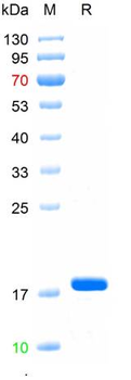 Recombinant PRRSV N protein, N-His