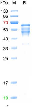 Recombinant human Caspase-3 protein, His & MBP