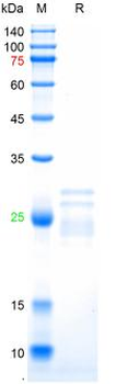 Recombinant human Ferritin (Heavy & Light Chain), His