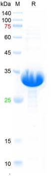 Recombinant human NGAL protein, His