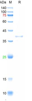 Recombinant human ST2 protein, His