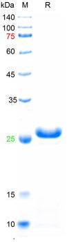 Recombinant mouse IL-1b protein, C-His