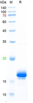 Recombinant human VILIP1 protein, C-His