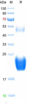 Recombinant human IL-6 protein, C-His