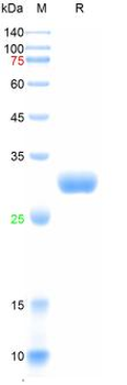 Recombinant human Adiponectin, N-His