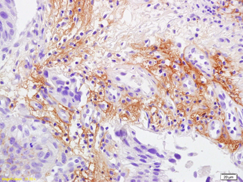 Laminin 2 alpha Rabbit Polyclonal Antibody