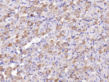 C-Kit Rabbit Polyclonal Antibody