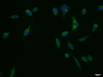 Phospho-ACACA (Ser1263) Rabbit Polyclonal Antibody