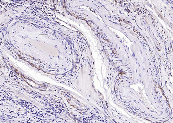 Alpha smooth muscle Actin Rabbit Polyclonal Antibody