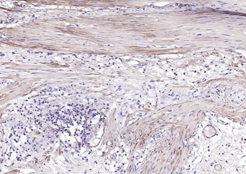 Alpha smooth muscle Actin Rabbit Polyclonal Antibody
