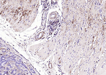 Alpha smooth muscle Actin Rabbit Polyclonal Antibody