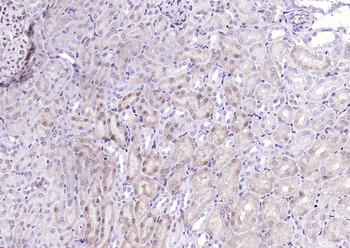 ADRM1 Rabbit Polyclonal Antibody