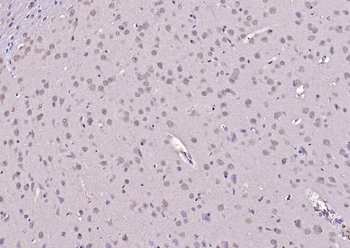 ADRM1 Rabbit Polyclonal Antibody