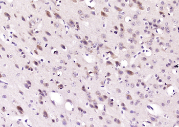 AKR1C3 Rabbit Polyclonal Antibody