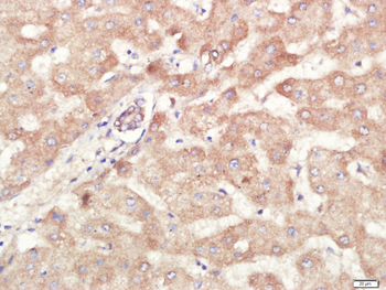 ALDH1A1 Rabbit Polyclonal Antibody