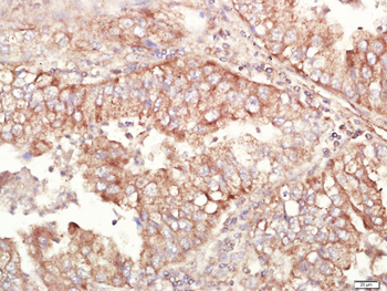 ALDH1A1 Rabbit Polyclonal Antibody