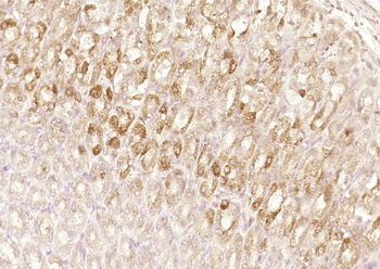 ANKRD5 Rabbit Polyclonal Antibody