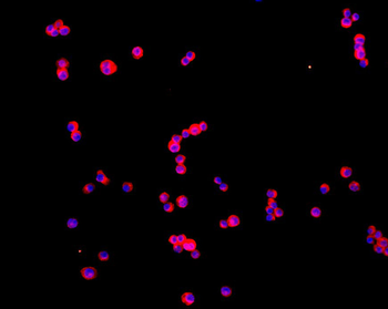 Arginase II Rabbit Polyclonal Antibody