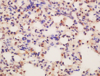 ASCL2 Rabbit Polyclonal Antibody