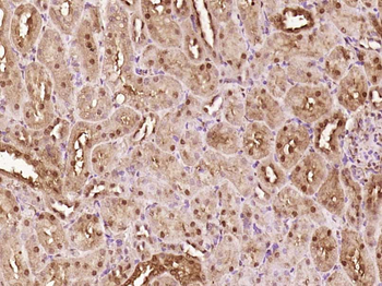 ATBF1 Rabbit Polyclonal Antibody
