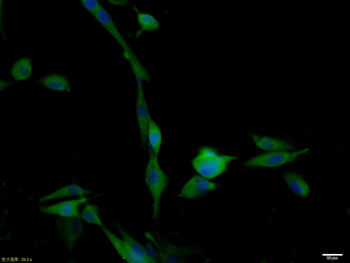 BBS1 Rabbit Polyclonal Antibody