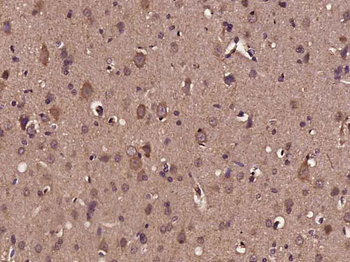 BDNF Rabbit Polyclonal Antibody