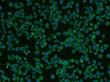 BDNF Rabbit Polyclonal Antibody