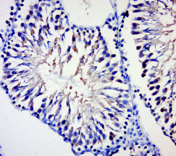 BPTF Rabbit Polyclonal Antibody