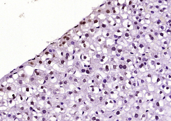 BPTF Rabbit Polyclonal Antibody