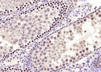 BPTF Rabbit Polyclonal Antibody