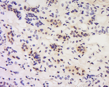Calcipressin 1/DSCR 1 Rabbit Polyclonal Antibody