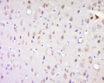 Phospho-Caseine Kinase 1 alpha (Tyr294) Rabbit Polyclonal Antibody