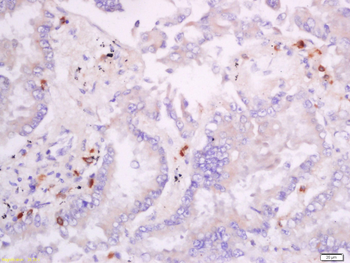 CD28 Rabbit Polyclonal Antibody