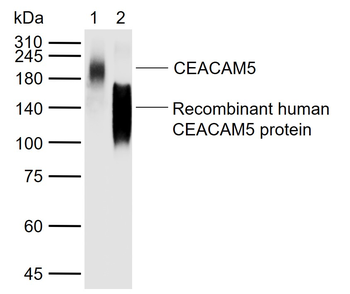 CEA Mouse Monoclonal Antibody