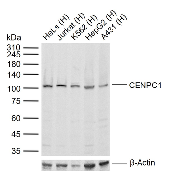 CENPC1 Rabbit Polyclonal Antibody
