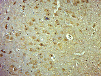 Phospho-Cofilin (Ser24) Rabbit Polyclonal Antibody