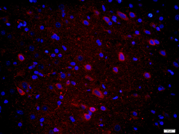 CPLX1 Rabbit Polyclonal Antibody