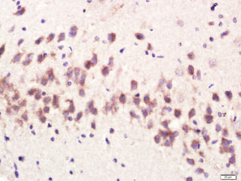 CPLX1 Rabbit Polyclonal Antibody