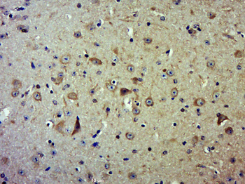 CSK Rabbit Polyclonal Antibody