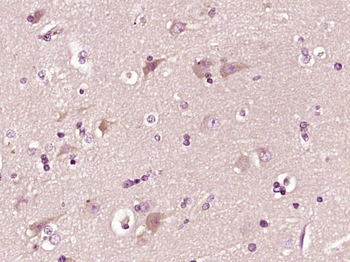 CTRP2 Rabbit Polyclonal Antibody