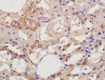 DIAPH2 Rabbit Polyclonal Antibody