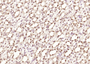 DYX1C1 Rabbit Polyclonal Antibody