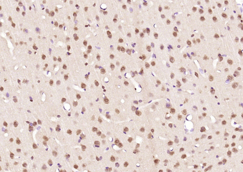 DYX1C1 Rabbit Polyclonal Antibody