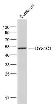 DYX1C1 Rabbit Polyclonal Antibody