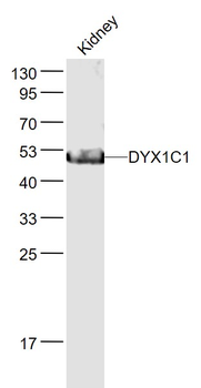 DYX1C1 Rabbit Polyclonal Antibody