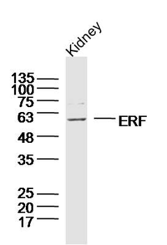 ERF Rabbit Polyclonal Antibody
